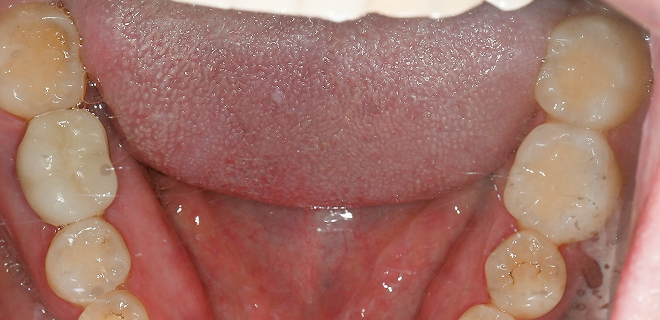 After